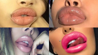 Category: Full Lips